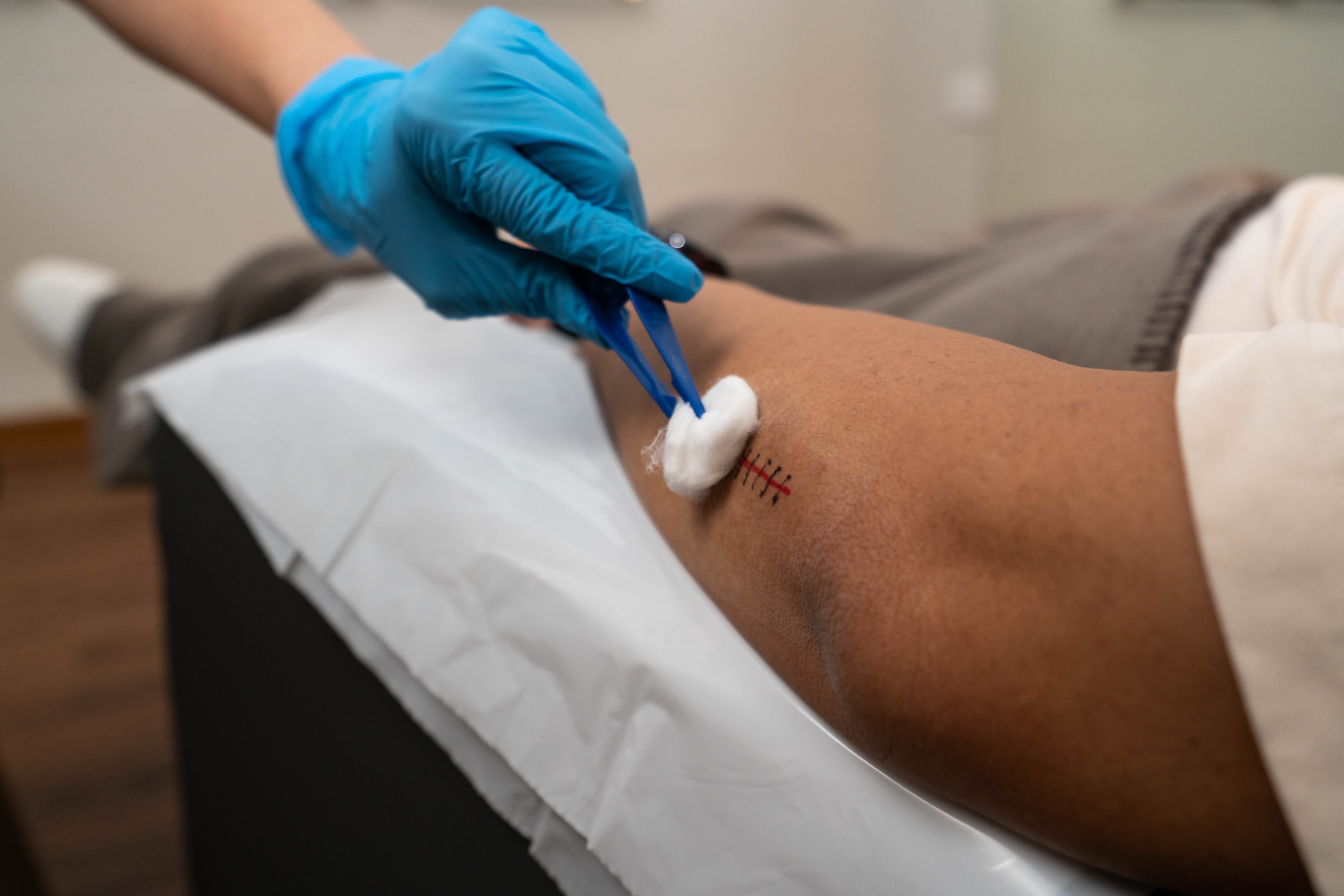 Wound Care