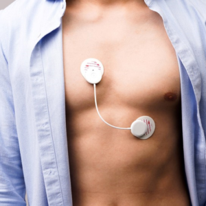 S-Patch Cardio continuous ECG 24Hrs monitoring