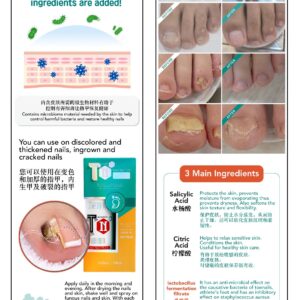 Dr ITN Tinea